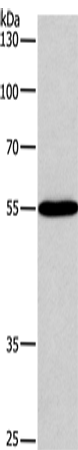 Rabbit Polyclonal Antibody to BLK