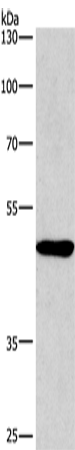 Rabbit Polyclonal Antibody to BMP15