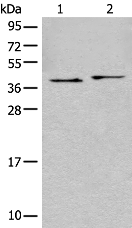 Rabbit Polyclonal Antibody to BRCC3