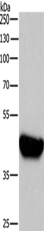 Rabbit Polyclonal Antibody to BABAM2