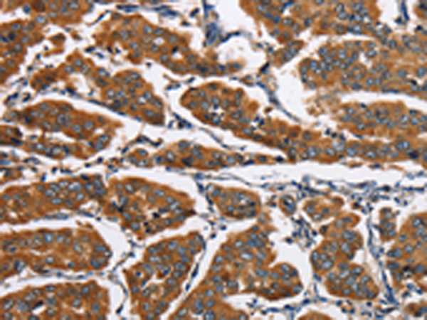 Rabbit Polyclonal Antibody to EIF4EBP2