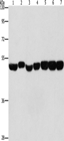Rabbit Polyclonal Antibody to ENO1