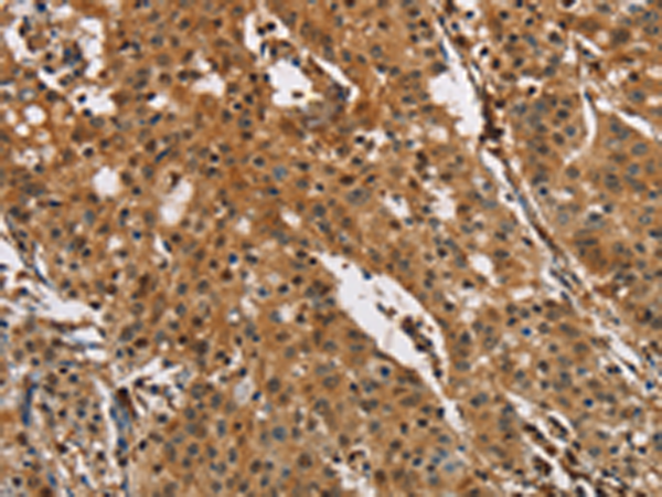 Rabbit Polyclonal Antibody to PTK6