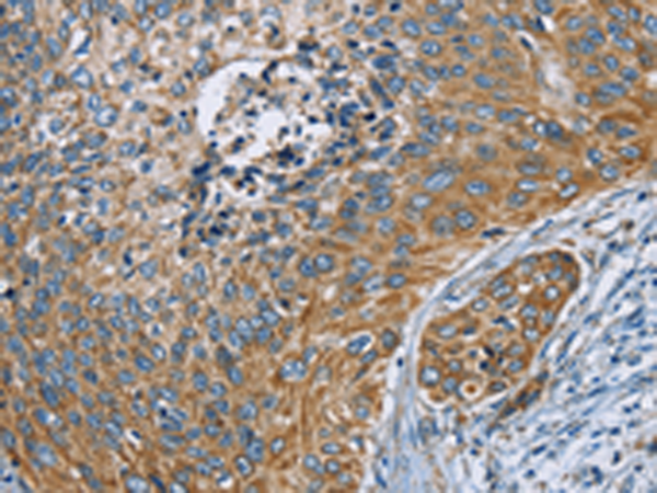 Rabbit Polyclonal Antibody to ZMYND11