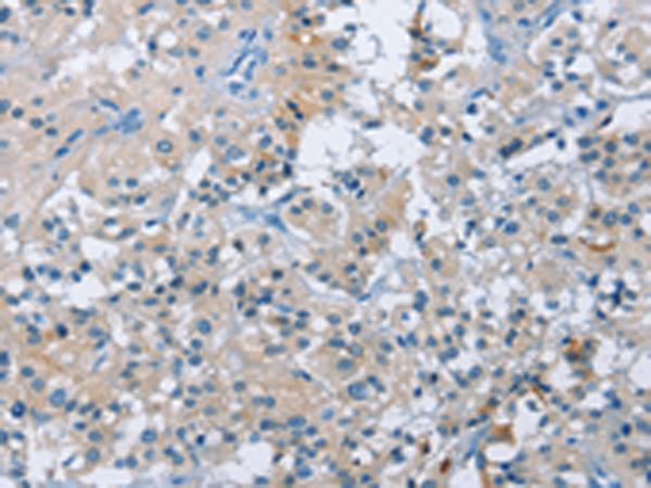 Rabbit Polyclonal Antibody to BTN2A2