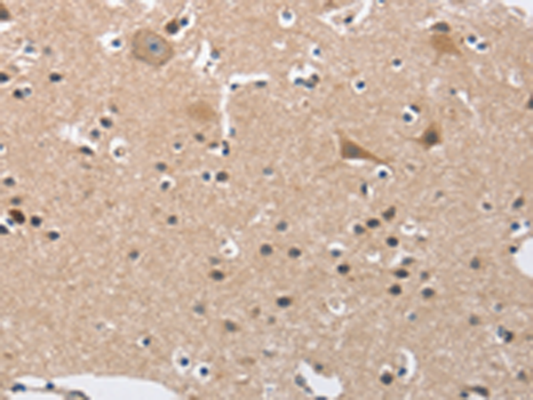 Rabbit Polyclonal Antibody to BUB1