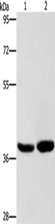 Rabbit Polyclonal Antibody to CAB39L