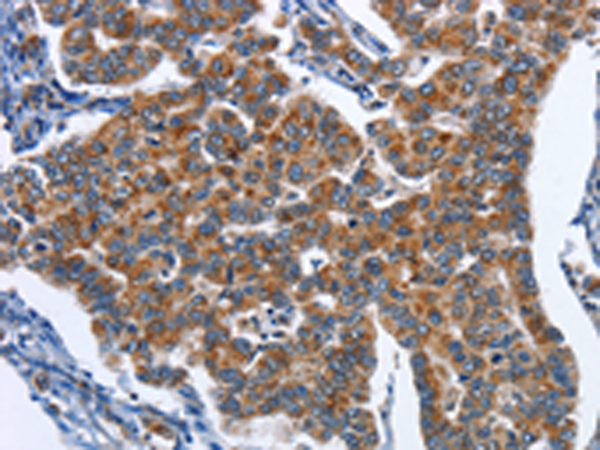 Rabbit Polyclonal Antibody to CADM3