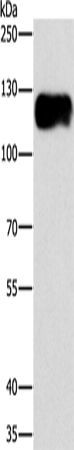 Rabbit Polyclonal Antibody to CAST
