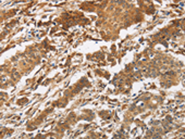 Rabbit Polyclonal Antibody to CALU