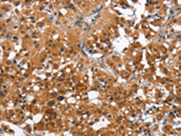 Rabbit Polyclonal Antibody to CAMK1D