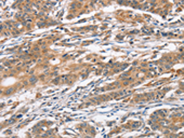 Rabbit Polyclonal Antibody to CAMK4