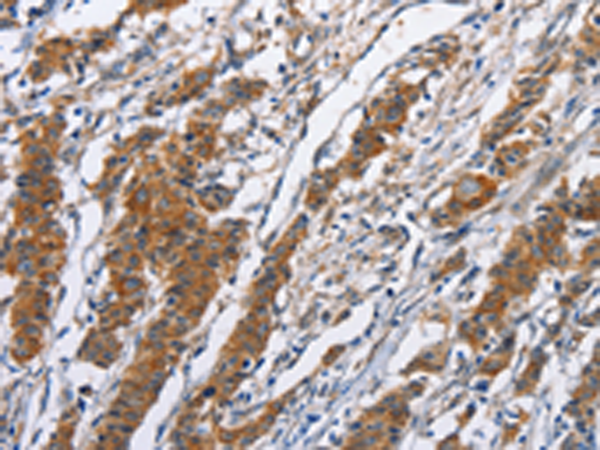 Rabbit Polyclonal Antibody to NCAPD3