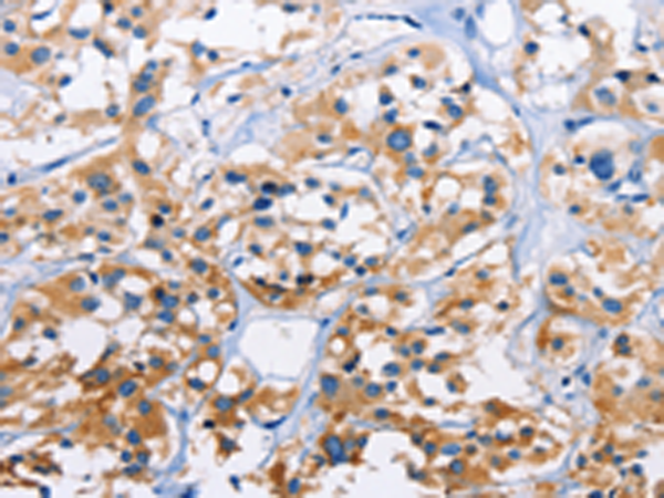 Rabbit Polyclonal Antibody to CAPZA3