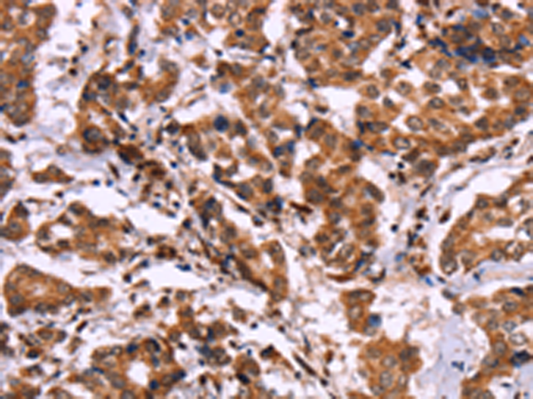 Rabbit Polyclonal Antibody to CARD11