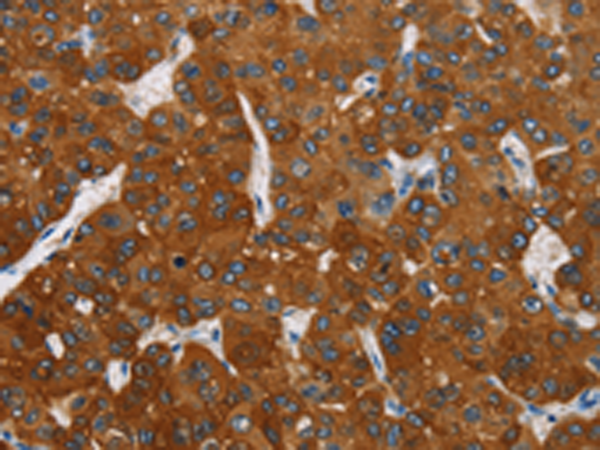 Rabbit Polyclonal Antibody to CARD9