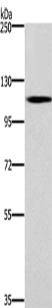 Rabbit Polyclonal Antibody to CARD14