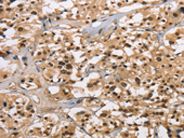 Rabbit Polyclonal Antibody to CARD8