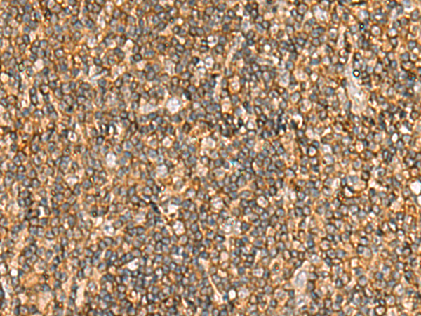 Rabbit Polyclonal Antibody to NLRC4