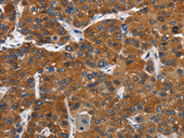 Rabbit Polyclonal Antibody to CATSPER3