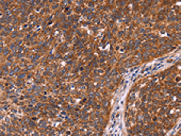 Rabbit Polyclonal Antibody to CCDC106