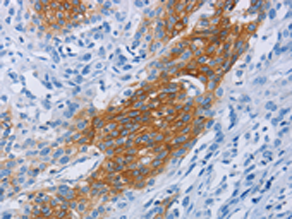 Rabbit Polyclonal Antibody to CCR9