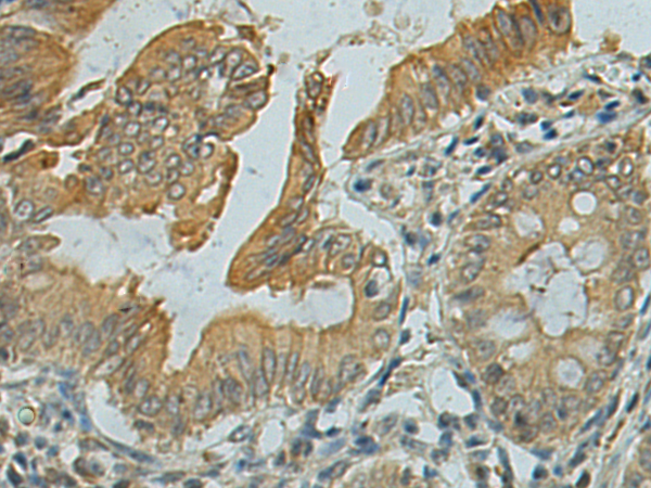 Rabbit Polyclonal Antibody to ENG