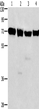 Rabbit Polyclonal Antibody to IL2RB