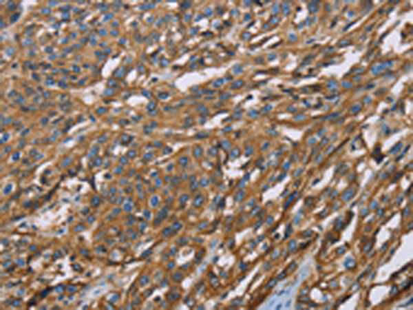 Rabbit Polyclonal Antibody to BSG