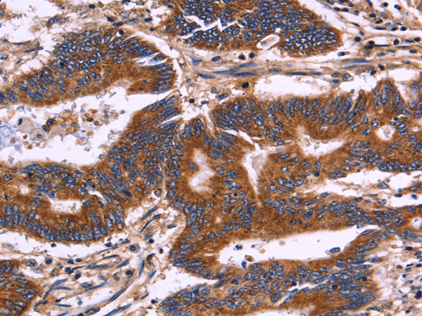Rabbit Polyclonal Antibody to KIR2DL3
