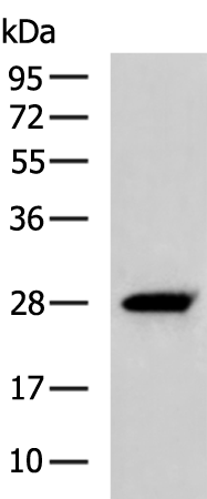 Rabbit Polyclonal Antibody to KLRB1