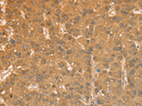 Rabbit Polyclonal Antibody to CXCR4