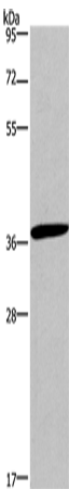 Rabbit Polyclonal Antibody to CD1A