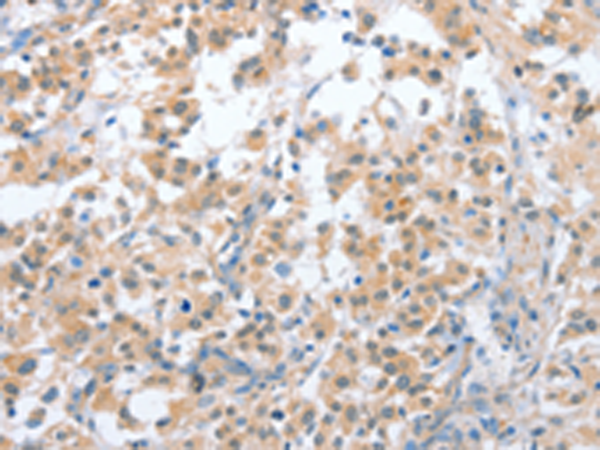 Rabbit Polyclonal Antibody to CD200R1