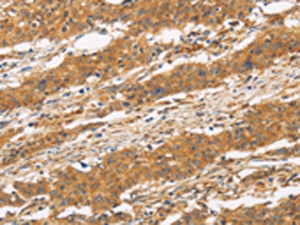 Rabbit Polyclonal Antibody to CD22