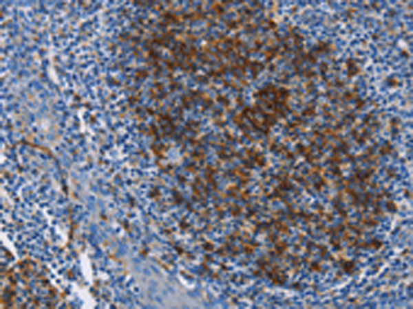 Rabbit Polyclonal Antibody to FCER2
