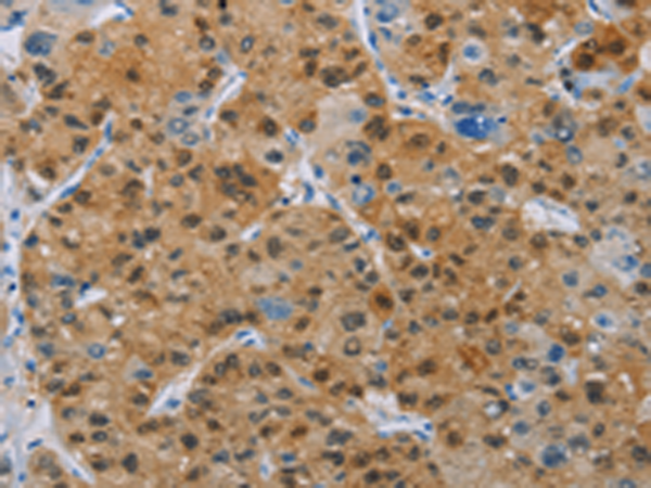 Rabbit Polyclonal Antibody to BTLA