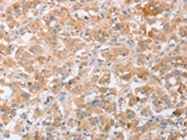 Rabbit Polyclonal Antibody to SIGLEC9