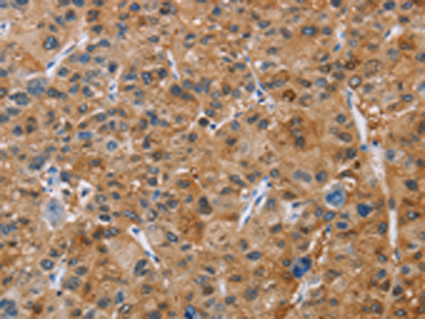 Rabbit Polyclonal Antibody to NCR3