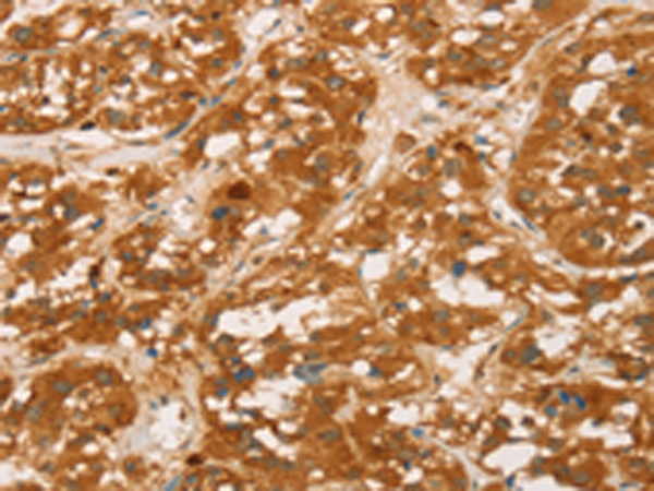 Rabbit Polyclonal Antibody to SPN