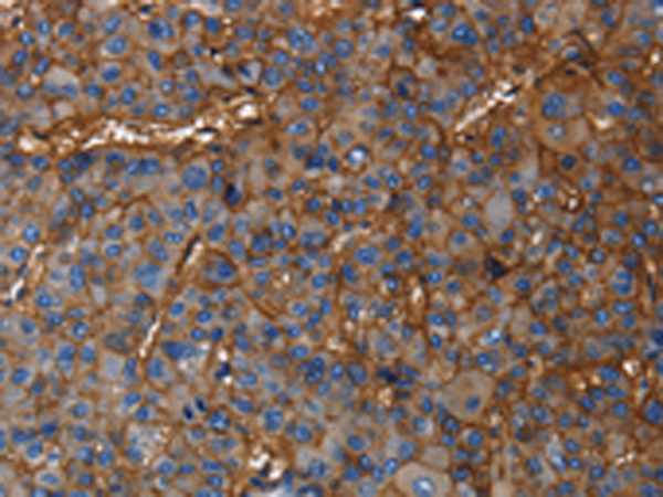 Rabbit Polyclonal Antibody to CD46