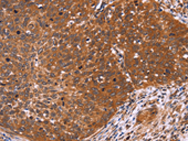 Rabbit Polyclonal Antibody to CDC37L1