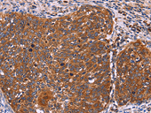Rabbit Polyclonal Antibody to FBXW7