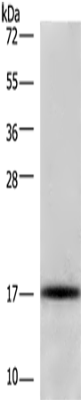 Rabbit Polyclonal Antibody to CDKN2C