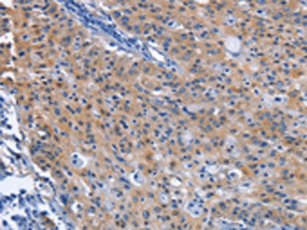 Rabbit Polyclonal Antibody to CDO1