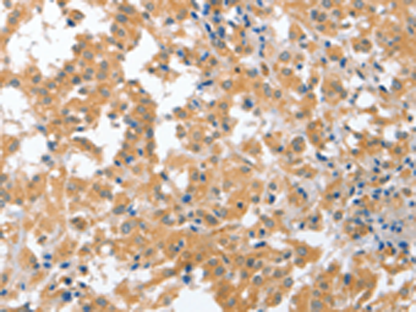 Rabbit Polyclonal Antibody to CDR2
