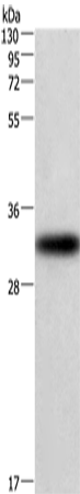Rabbit Polyclonal Antibody to CENPP