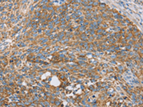 Rabbit Polyclonal Antibody to CENPO