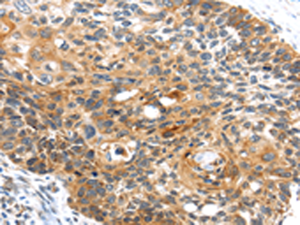 Rabbit Polyclonal Antibody to CENPM