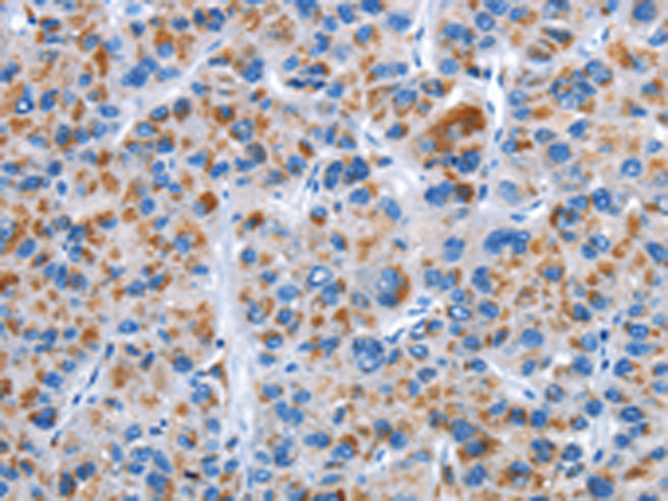 Rabbit Polyclonal Antibody to CENPJ